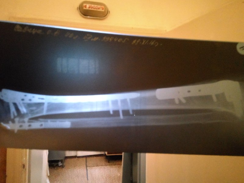 2017-01-12 11.42.20.jpg